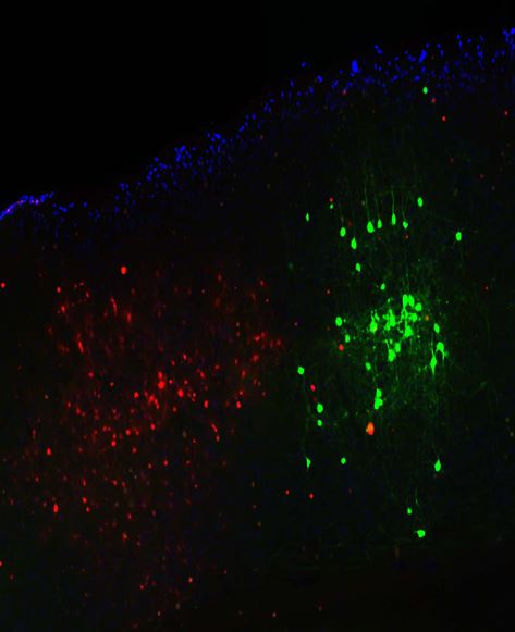 형광물질을 발현시킨 뇌 절편 영상에서의 신경세포의 분포