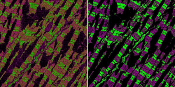 전자현미경으로 관찰한 쥐 심장 근육 사진의 노이즈 제거 전(왼쪽)과 후. 사진=네이쳐