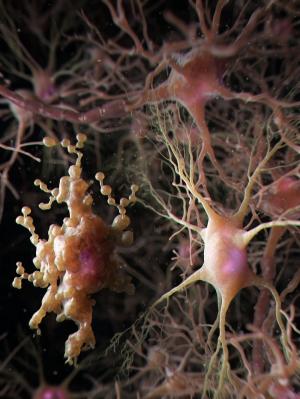 KAIST, 노화된 뇌에서 생겨난 비정상적  별아교세포 ‘아프다(APDA)’발견